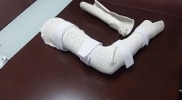 抚州南昌矫形器-步行矫型器在脊髓损伤中的作用