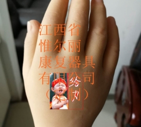 宜春江西假肢中心