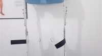 九江7种常见的侧弯南昌矫形器支具