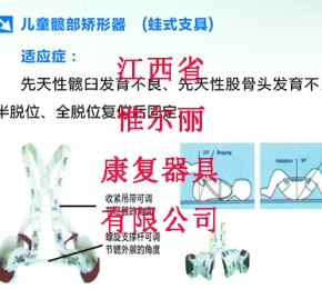 新余儿童髋部矫形器（蛙式支具）