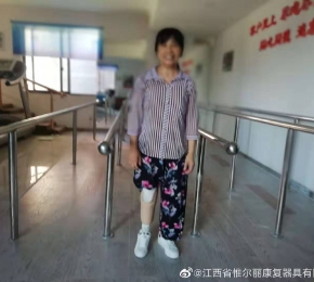 宜春九江假肢
