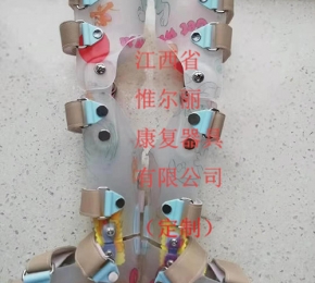 赣州南昌义肢公司